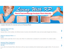 Tablet Screenshot of keratosis-pilaris-treatments.blogspot.com