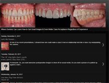 Tablet Screenshot of dentalphotography.blogspot.com