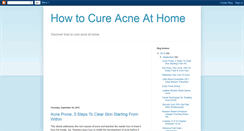 Desktop Screenshot of howtocureacneathome.blogspot.com