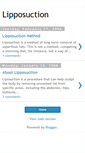 Mobile Screenshot of lipposuction.blogspot.com