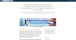 Desktop Screenshot of naturalcheilitiscure.blogspot.com