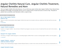 Tablet Screenshot of naturalcheilitiscure.blogspot.com