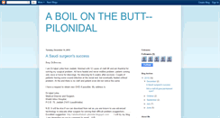 Desktop Screenshot of aboilonthebutt--pilonidal.blogspot.com