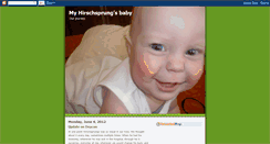 Desktop Screenshot of myhirschsprungsbaby.blogspot.com