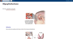 Desktop Screenshot of hipopituitarismo.blogspot.com