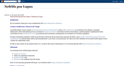 Desktop Screenshot of nefritisenlupus.blogspot.com