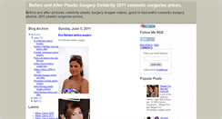 Desktop Screenshot of beforeandafter-plasticsurgery.blogspot.com