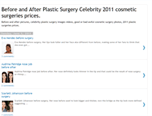 Tablet Screenshot of beforeandafter-plasticsurgery.blogspot.com