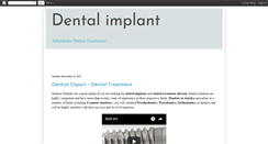Desktop Screenshot of dentalimplanttry.blogspot.com