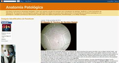 Desktop Screenshot of anatomia-patologica.blogspot.com