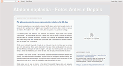 Desktop Screenshot of abdominoplastiafotosdepois.blogspot.com