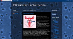 Desktop Screenshot of cancercu.blogspot.com