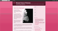 Desktop Screenshot of breast-cancer-pictures.blogspot.com