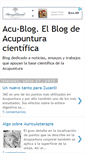 Mobile Screenshot of acu-blog.blogspot.com