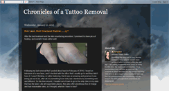 Desktop Screenshot of chroniclesofatattooremoval.blogspot.com