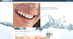 Desktop Screenshot of implantesdetitanio.blogspot.com