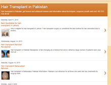 Tablet Screenshot of hairtransplantinpakistan.blogspot.com