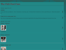 Tablet Screenshot of clubfeetcure.blogspot.com