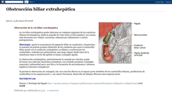 Desktop Screenshot of obstruccionbiliarextrahepatica.blogspot.com