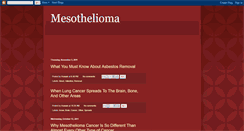 Desktop Screenshot of all-about-mesothelioma-4u.blogspot.com