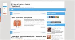 Desktop Screenshot of externalhemorrhoids-treatment.blogspot.com