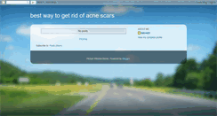 Desktop Screenshot of bestwaytogetridofacnescars.blogspot.com