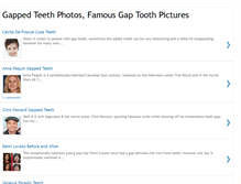 Tablet Screenshot of gappedteeth.blogspot.com