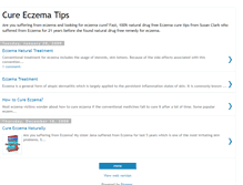 Tablet Screenshot of cureeczematips.blogspot.com