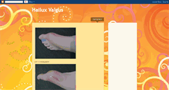 Desktop Screenshot of pes-hallux.blogspot.com