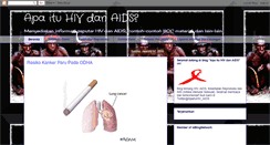 Desktop Screenshot of apaituhivdanaids.blogspot.com