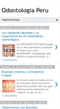 Mobile Screenshot of clinicaodontologiaperu.blogspot.com