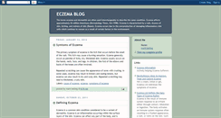 Desktop Screenshot of eczemablog.blogspot.com