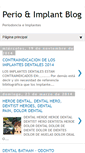 Mobile Screenshot of perionetblog.blogspot.com