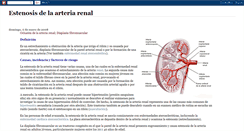 Desktop Screenshot of estenosisarteriarenal.blogspot.com