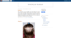 Desktop Screenshot of doencasraras-ctv.blogspot.com