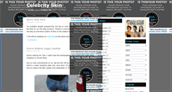 Desktop Screenshot of celebskinblog.blogspot.com