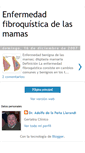 Mobile Screenshot of enfermedadfibroquisticamamas.blogspot.com