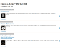 Tablet Screenshot of neuroradiologyonthenet.blogspot.com