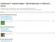 Tablet Screenshot of implantate.blogspot.com