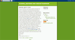 Desktop Screenshot of eczemapsoriasisnewnaturaltreatment.blogspot.com