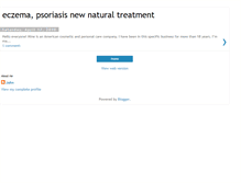 Tablet Screenshot of eczemapsoriasisnewnaturaltreatment.blogspot.com