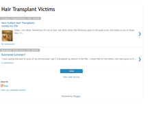Tablet Screenshot of hairtransplantvictim.blogspot.com