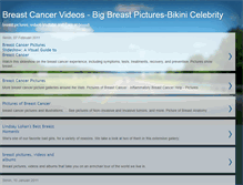 Tablet Screenshot of breastcancer69.blogspot.com