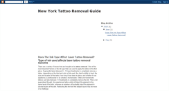 Desktop Screenshot of newyorktattooremovalguide.blogspot.com