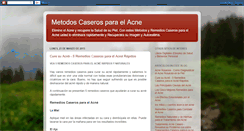 Desktop Screenshot of metodoscaserosparaelacne.blogspot.com