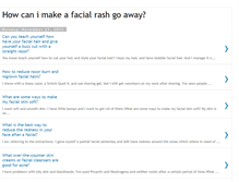 Tablet Screenshot of make-rash-go-away.blogspot.com