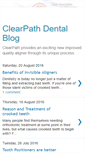 Mobile Screenshot of clearpath-dental.blogspot.com