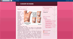Desktop Screenshot of cancerdemamadiana.blogspot.com