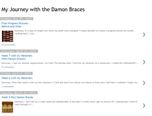 Tablet Screenshot of damon-braces.blogspot.com
