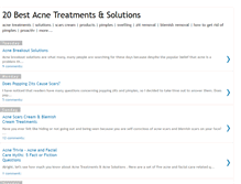 Tablet Screenshot of 20bestacnetreatments.blogspot.com